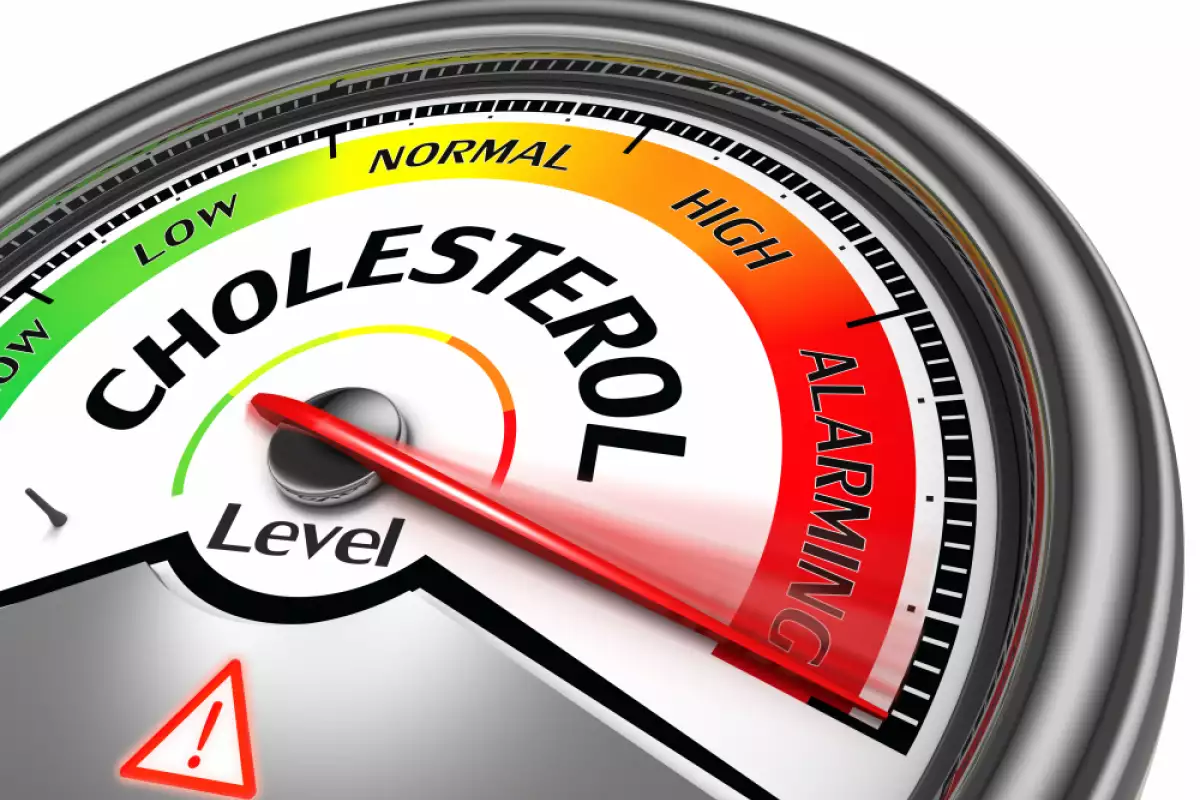 Симптоми при Висок Холестерол