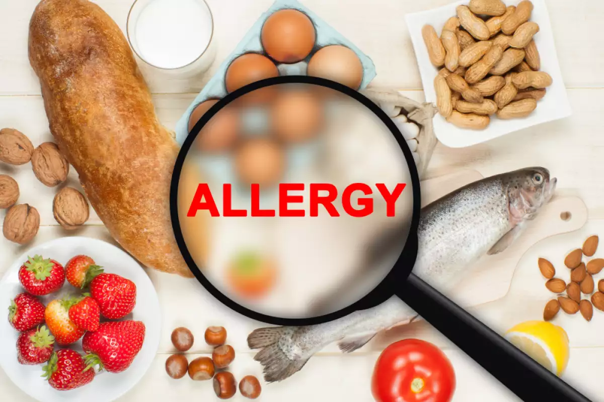 Хранителната алергия е състояние при което определени храни предизвикват необичаен