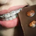 Как да се храним с брекети?